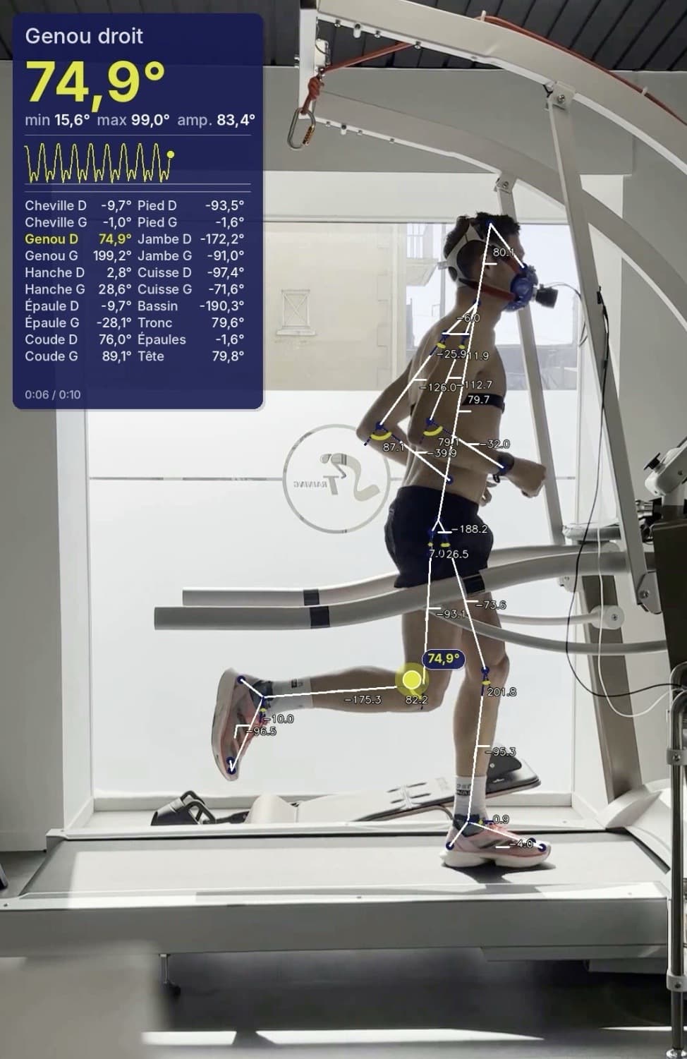 Analyse biomécanique vidéo Synkro